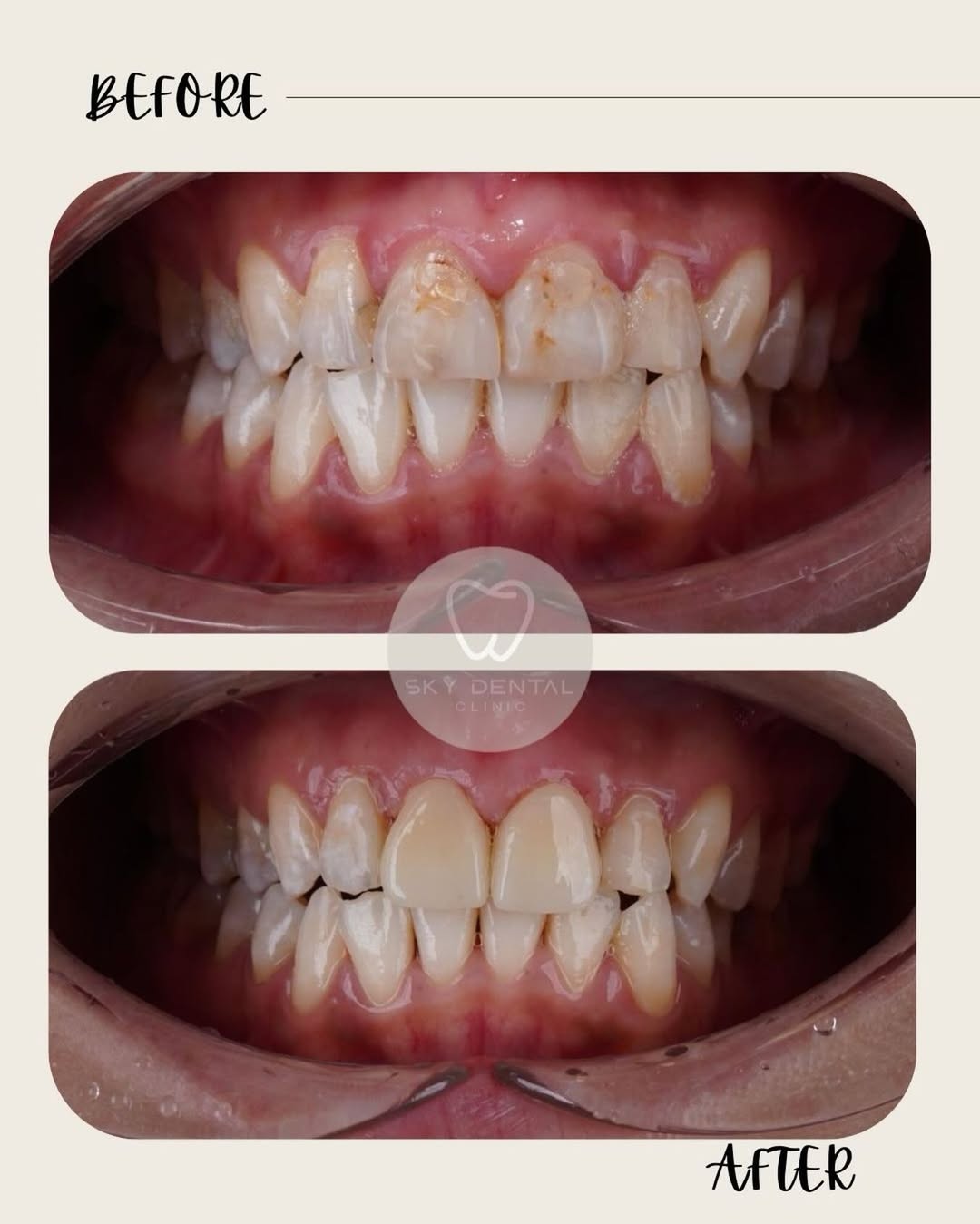 Treatment Result 1
