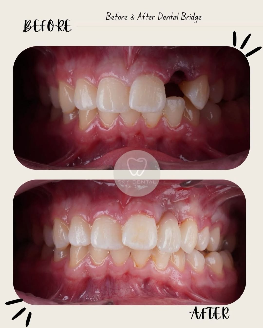 Treatment Result 2