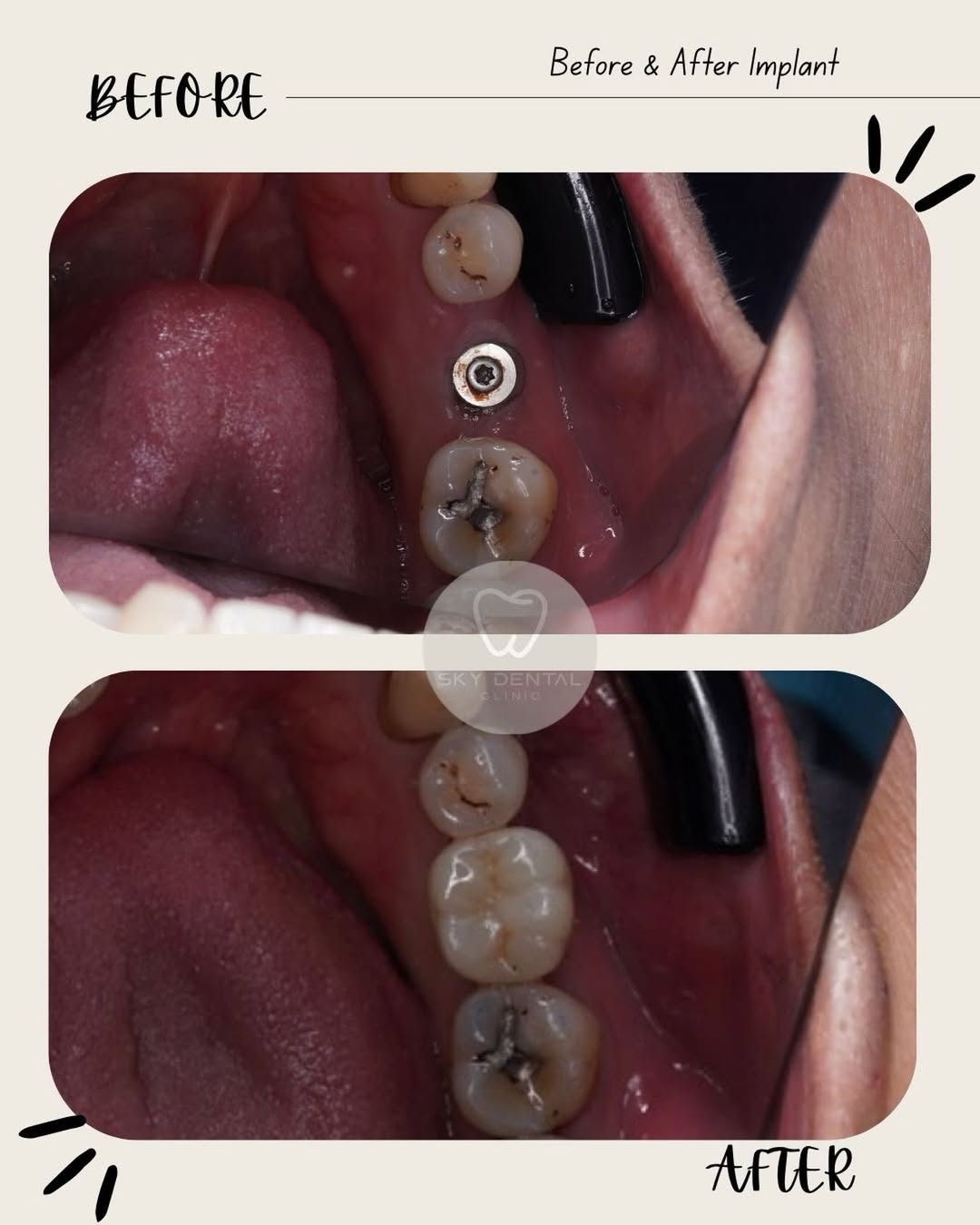 Treatment Result 3