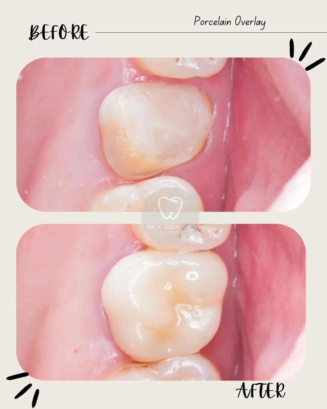 Treatment Result 4